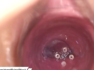Camera in the vagina